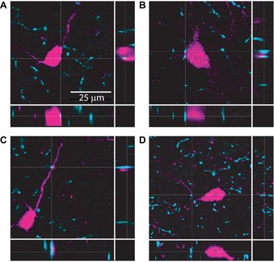 α3β4∗ Nicotinic Acetylcholine Receptors Strongly Modulate the Excitability of VIP Neurons in the Mouse Inferior Colliculus